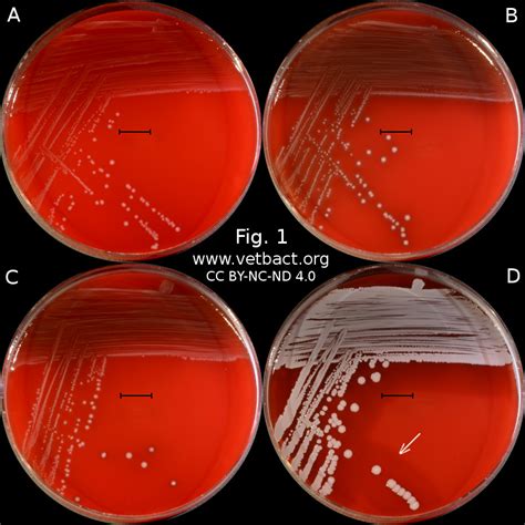 Listeria monocytogenes on blood agar. Hemolysis On Blood Agar - cloudshareinfo