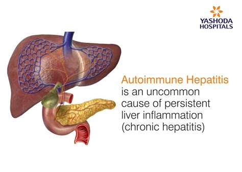 Autoimmune Hepatitis Symptoms Causes And Treatment