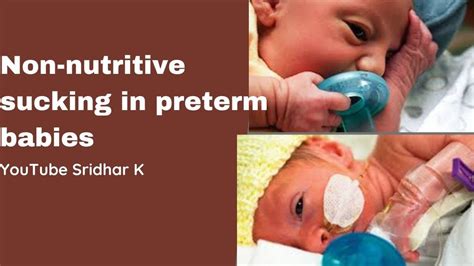 What Is Non Nutritive Sucking Feeding Preterm Baby Series Dr Sridhar