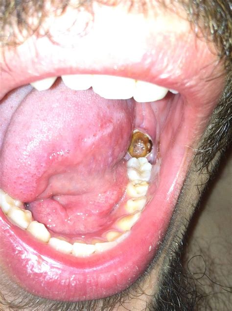 Here are the warning signs you should you get suspicious shortcut files. My boyfriend's infected tooth. : WTF