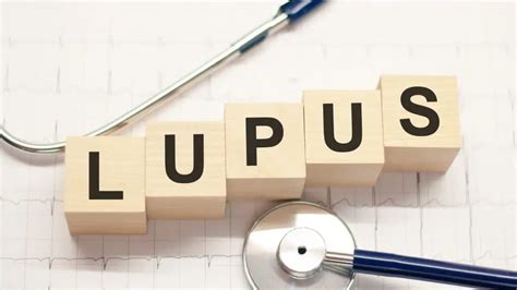 Kako Prepoznati Lupus Arz Hr
