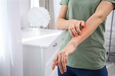 Mengetahui Penyebab Dan Cara Menangani Alergi Kulit Alodokter