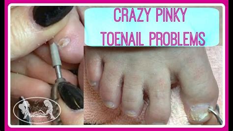Crazy Pinky Toenails Pedicure Tutorial Giveaway Opportunity Youtube
