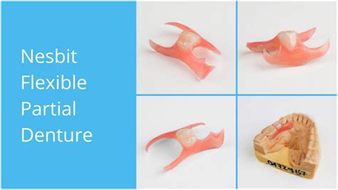 5 Advantages Of Nesbit Flexible Partial Denture From Dental Lab Direct