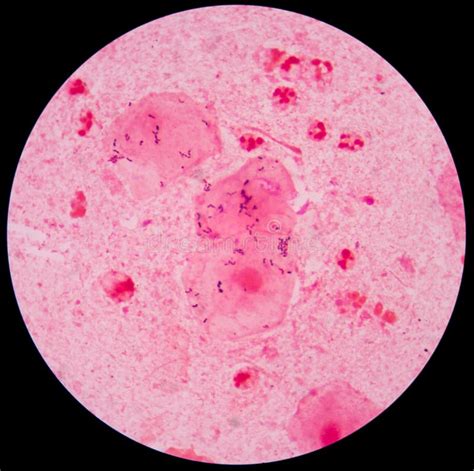Red Leukocyte In Sputum Gram Stain Stock Photo Image 63192913