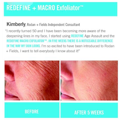 Assault Your Age With Redefine Rodan And Fields Consultant Rodan And