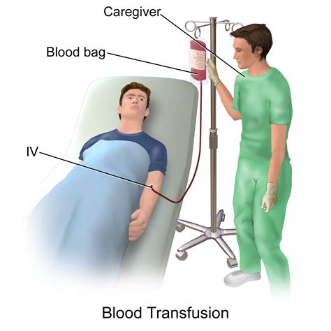 Blood Transfusion Simple English Wikipedia The Free Encyclopedia