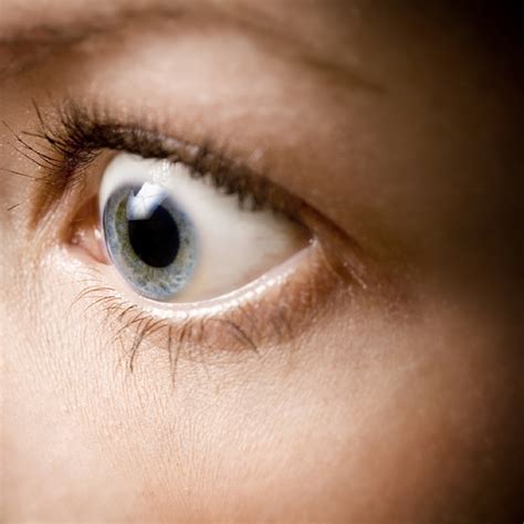 Graves Eye Disease Graves Ophthalmopathy Or Graves Orbitopathy Go