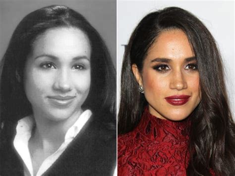 Meghan Markle Before And After In 2020 Celebrity Plastic Surgery