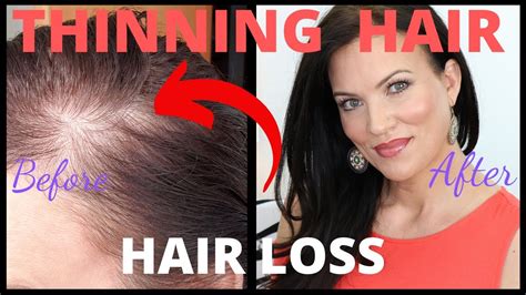 Fix Thinning Hair And Bald Spots In Seconds Female Hair Loss