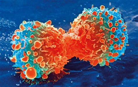 Engineered Immune Cells Deliver Anticancer Sign Prevent Cancer From