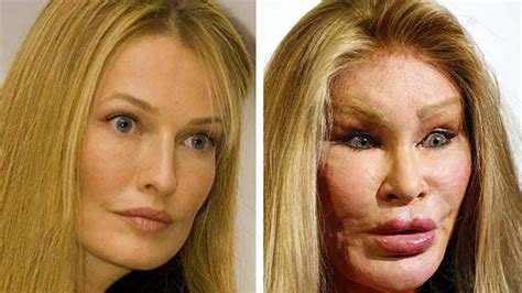 This Woman Is Addicted To Scary Plastic Surgery Youtube