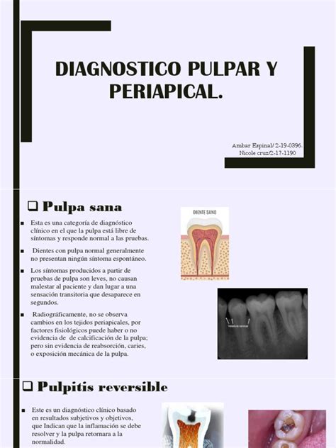 Diagnostico Pulpar Y Periapical Pdf Medicina Clinica
