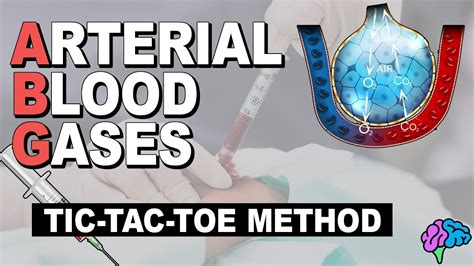 Tic Tac Toe Method Arterial Blood Gas Abg Interpretation For Nurses