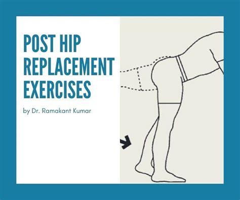 Yoga Poses To Avoid After Hip Replacement Yoga Poses