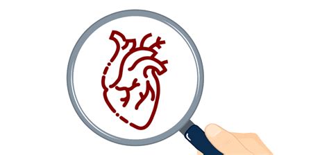 Atrial Septal Defect Short Reference Article Clinical Odyssey By