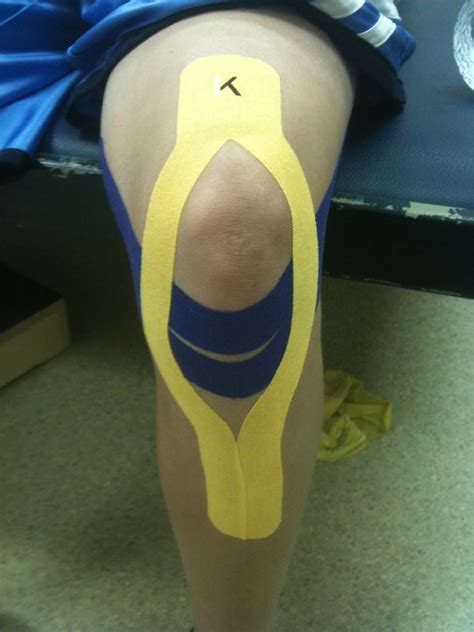 Kt Tape For Osgood Schlatter Kt Tape For Osgood Schlatter Flickr