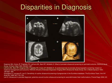 Ppt 3 And 4 Dimensional Ultrasound Imaging In Obstetrics Powerpoint
