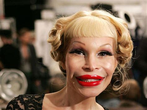 Plastic Surgery Gone Wrong Pictures That Will Make You Feel