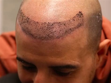 A Guide To Hairline Tattoos Man Of Many