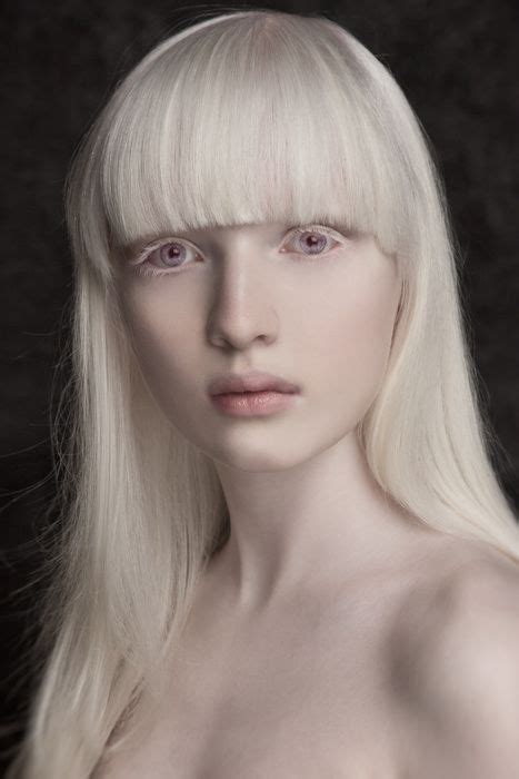 Sanz L Na C Photographe Personal Albino Model Albino Girl Portrait