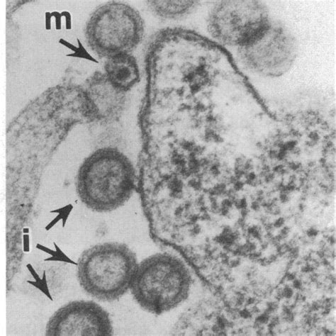 Electron Microscopy Of Hiv Particles Obtained From Cv 1 Cells Infected Download Scientific