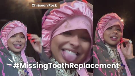 Chrisean Rock New Look Replacing Missing Tooth Transformations