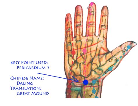Acuthink Acupuncture For Carpal Tunnel Syndrome