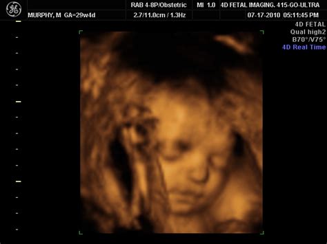 Baby 2 Ultrasound 29 Weeks Chuck Mortimore Flickr
