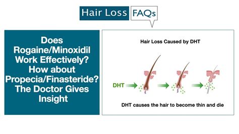Complete Guide To Minoxidil For Men And Women