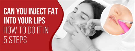 Can You Inject Fat Into Your Lips How To Do It In 5 Steps Dr Numb®