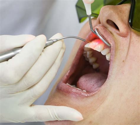 Can Lasers Help My Teeth And Gums Dr Taller Dental