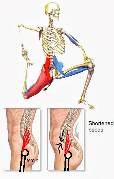 If your hip flexors are too tight (or too staying active is one of the very best things you can do to prevent hip and lower back tightness — as long as the duration and intensity of your activity is. Pin on Back pain