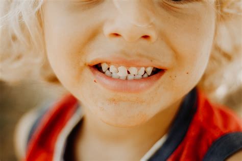 Child Teeth Whitening 6 Tips To Do It Naturally Smilebar