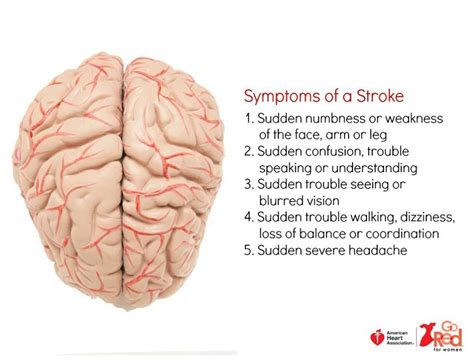 Symptoms Of A Stroke Diagram Of The Brain Stroke Brain Symptoms