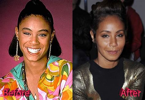 Jada Pinkett Smith Plastic Surgery A Bad Decision