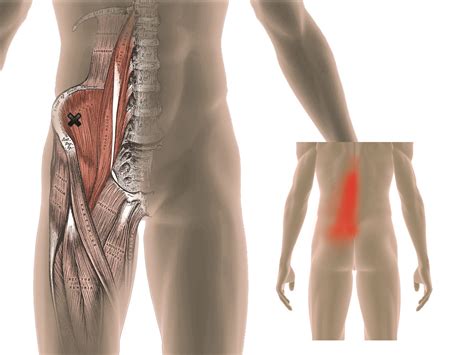 How To Release Psoas Trigger Points