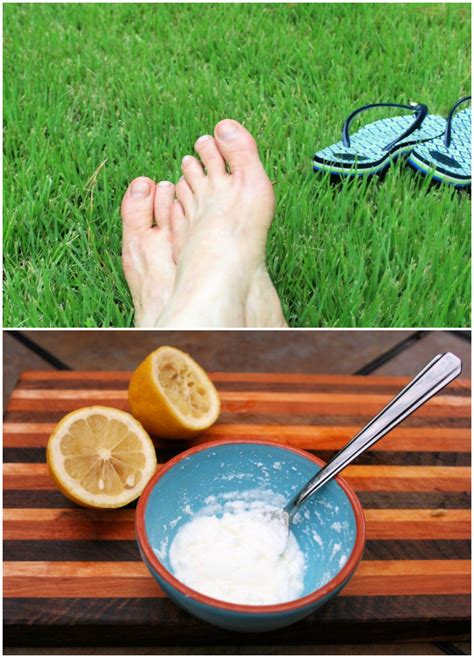 10 Quick And Easy Diy Foot Peel Recipes That Actually Work