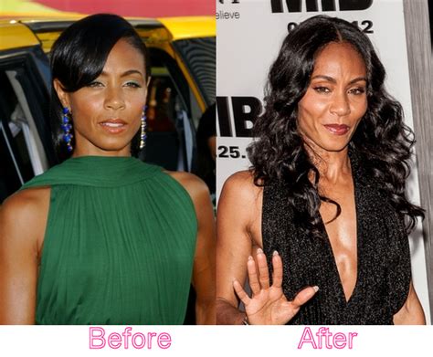 Jada Pinkett Smith Plastic Surgery Before And After Cheek Plumped And