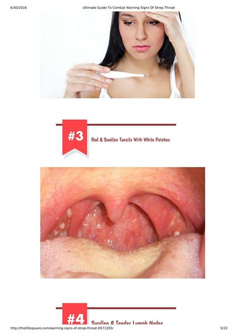 ppt ultimate guide to combat warning signs of strep throat powerpoint presentation id 7362558