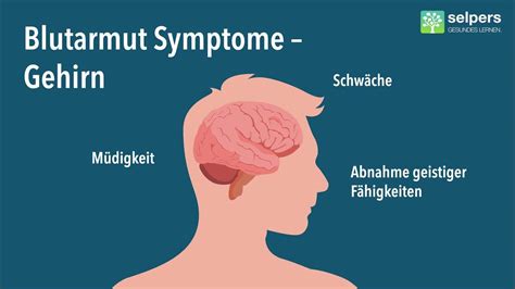 Symptome Bei Mds Myelodysplastisches Syndrom Blutarmut Anämie Experte Erklärt Youtube