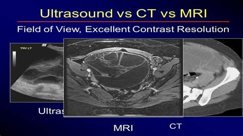 Difference Between Ct Scan And Mri Imaging