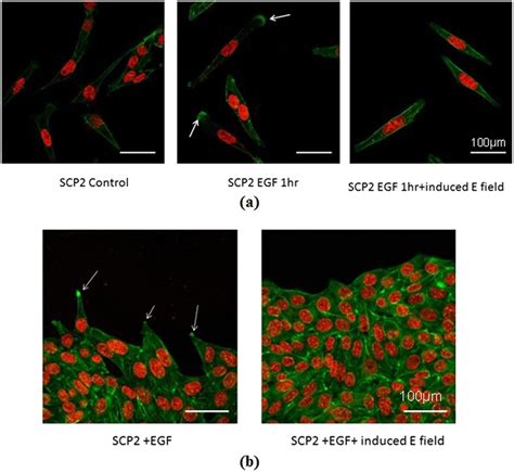 Visualization Of Actin Filaments By Fluorescence Microscopy A Left