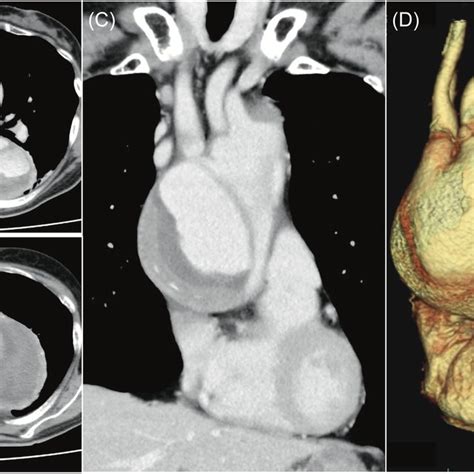 Ad Preoperative Contrast‐enhanced Computed Tomography Ct Image