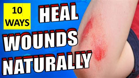 10 Natural Ways To Heal Wounds And Scrapes Fast And Quickly Youtube