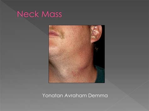 Ppt Neck Mass Powerpoint Presentation Free Download Id6059901