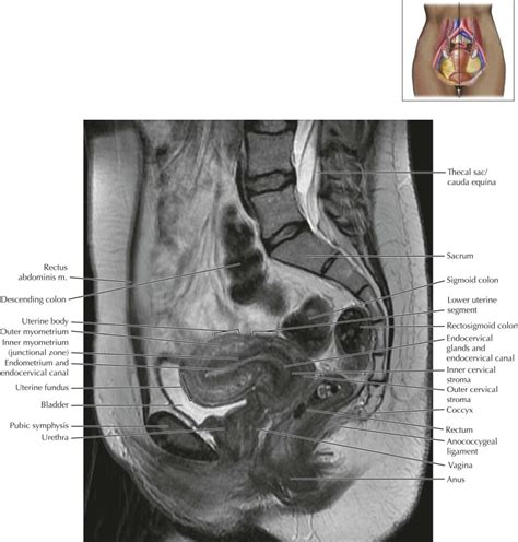 Female Pelvis Radiology Key