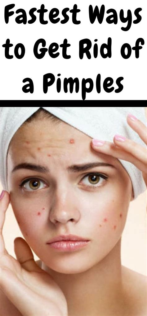 Fastest Ways To Get Rid Of A Pimples How To Get Rid Of Acne Acne