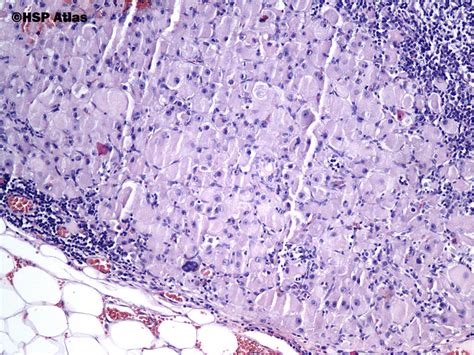 Hsp Atlas Histopathology Atlas