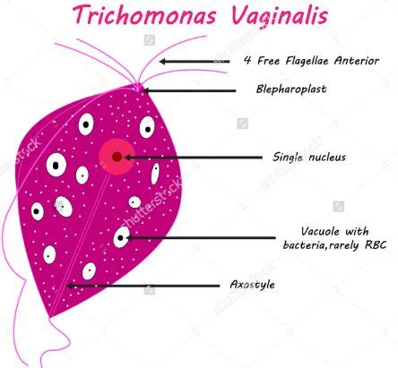 Trichomonas Vaginalis Pictures What Is Treatment Symptoms Causes